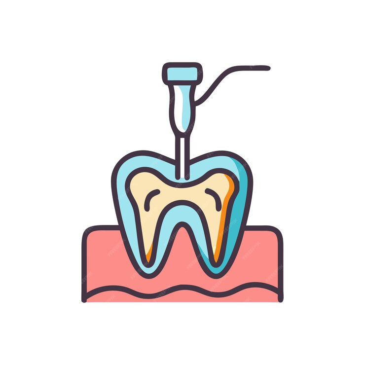 Root Canal